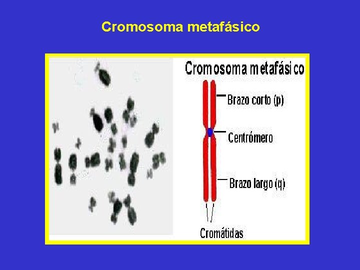 Cromosoma metafásico Cromosoma metafásico
