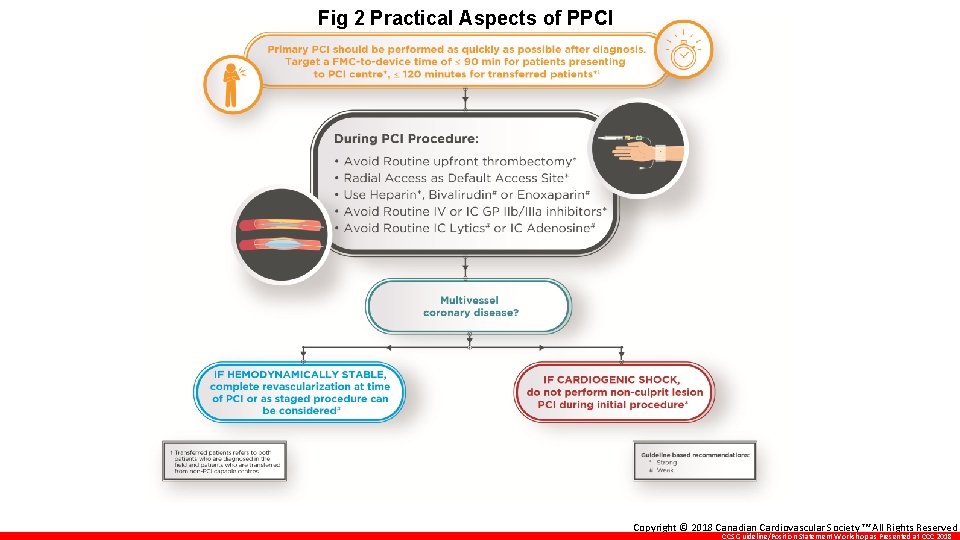 Fig 2 Practical Aspects of PPCI Copyright © 2018 Canadian Cardiovascular Society ™ All