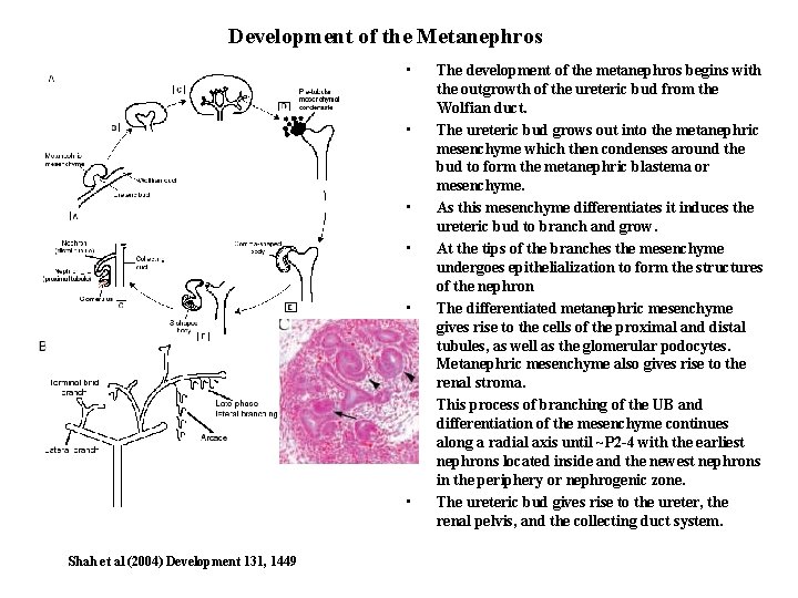 Development of the Metanephros • • Shah et al (2004) Development 131, 1449 The Development of the Metanephros • • Shah et al (2004) Development 131, 1449 The