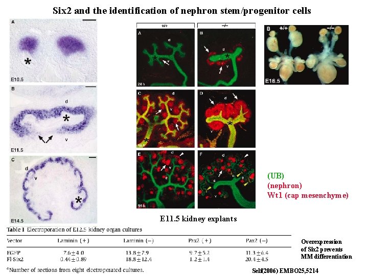Six 2 and the identification of nephron stem/progenitor cells (UB) (nephron) Wt 1 (cap Six 2 and the identification of nephron stem/progenitor cells (UB) (nephron) Wt 1 (cap