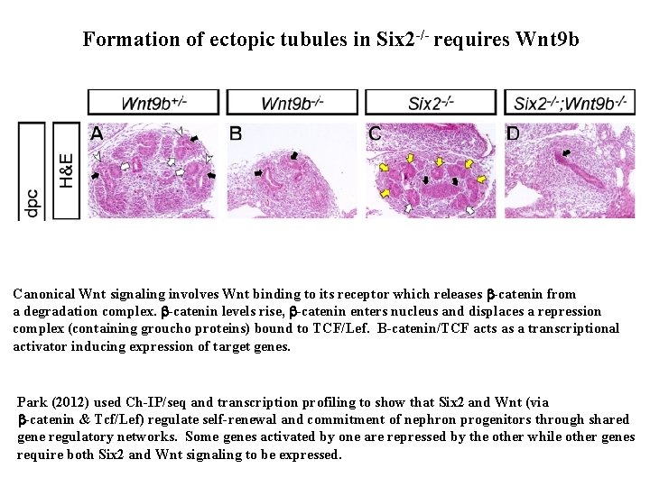 Formation of ectopic tubules in Six 2 -/- requires Wnt 9 b Canonical Wnt Formation of ectopic tubules in Six 2 -/- requires Wnt 9 b Canonical Wnt