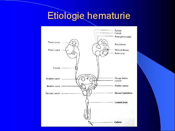 Etiologie hematurie 