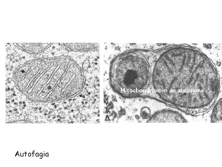 Autofagia 