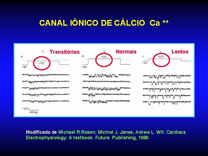 CANAL IÔNICO DE CÁLCIO Ca ++ Transitórios Normais Lentos Modificado de Michael R. Rosen,