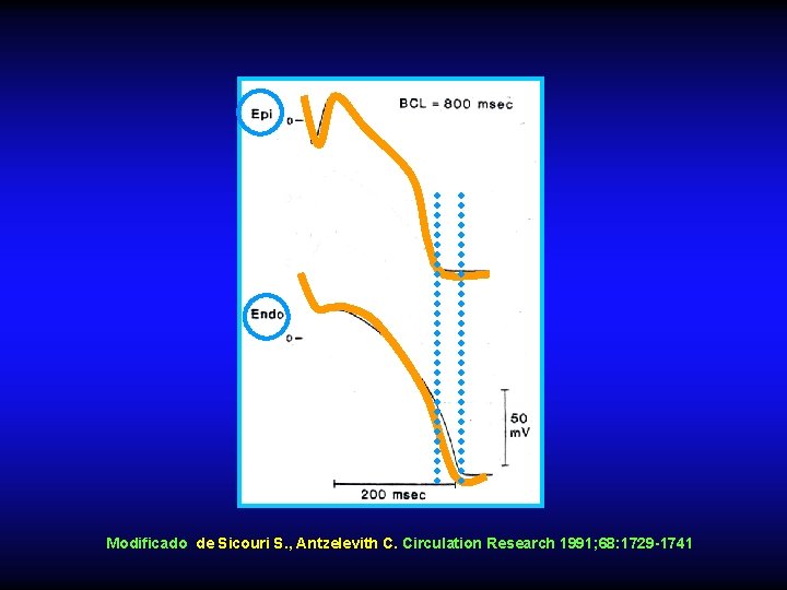 Modificado de Sicouri S. , Antzelevith C. Circulation Research 1991; 68: 1729 -1741 