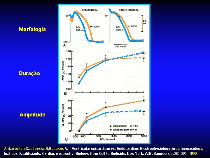 Morfologia Duração Amplitude Antzelevitch, C. ; Litovsky, S. H. ; Lukas, A. – Ventricular