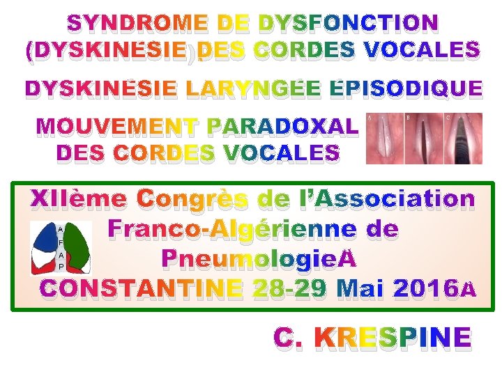 SYNDROME DE DYSFONCTION (DYSKINÉSIE)DES CORDES VOCALES DYSKINÉSIE LARYNGÉE ÉPISODIQUE MOUVEMENT PARADOXAL DES CORDES VOCALES