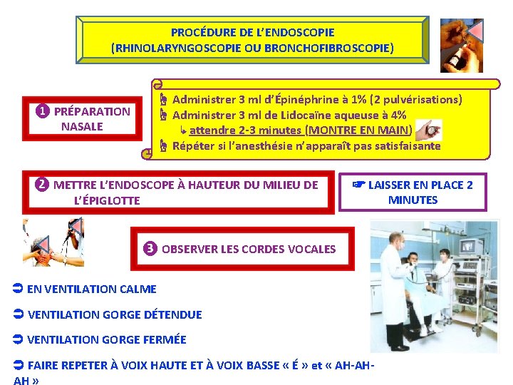 PROCÉDURE DE L’ENDOSCOPIE (RHINOLARYNGOSCOPIE OU BRONCHOFIBROSCOPIE) ❶ PRÉPARATION NASALE ☝ Administrer 3 ml d’Épinéphrine