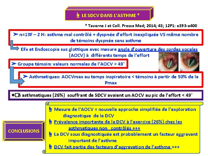 ☝ LE SDCV DANS L’ASTHME * * Taverne J et Coll. Presse Med; 2014;