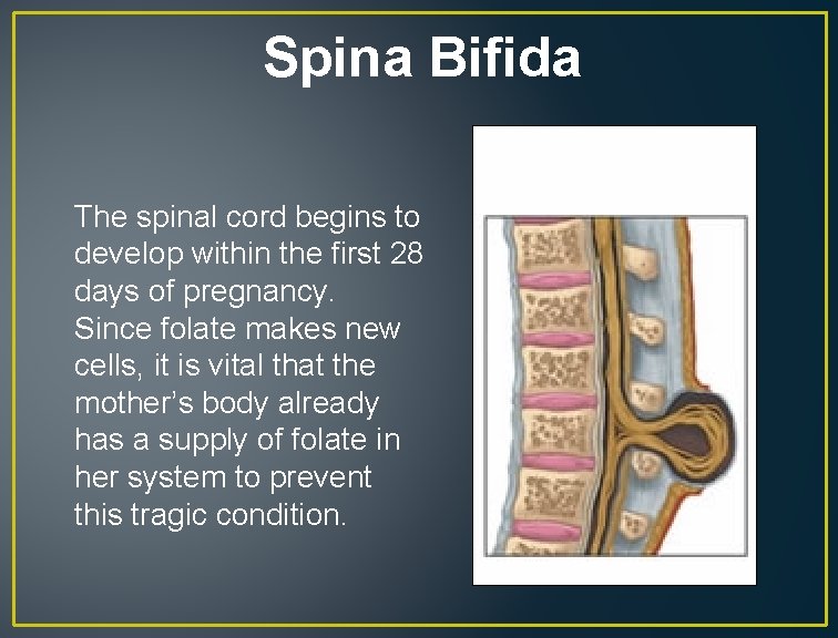 Spina Bifida The spinal cord begins to develop within the first 28 days of