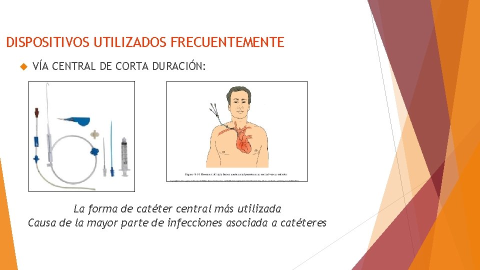 DISPOSITIVOS UTILIZADOS FRECUENTEMENTE VÍA CENTRAL DE CORTA DURACIÓN: La forma de catéter central más