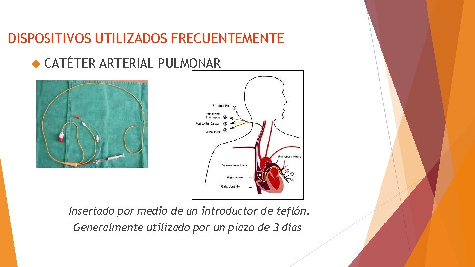 DISPOSITIVOS UTILIZADOS FRECUENTEMENTE CATÉTER ARTERIAL PULMONAR Insertado por medio de un introductor de teflón.