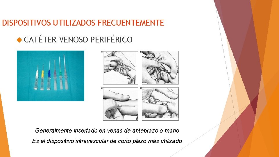 DISPOSITIVOS UTILIZADOS FRECUENTEMENTE CATÉTER VENOSO PERIFÉRICO Generalmente insertado en venas de antebrazo o mano