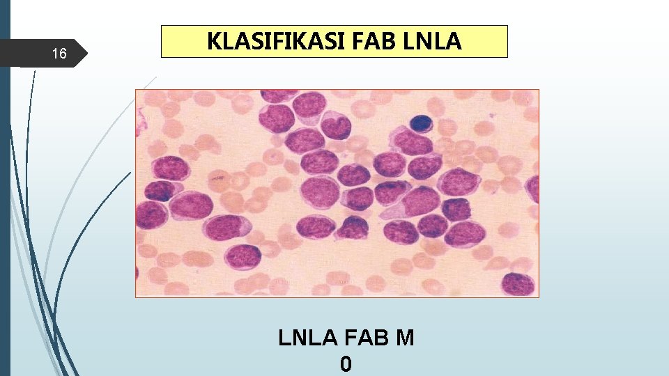 16 KLASIFIKASI FAB LNLA FAB M 0 