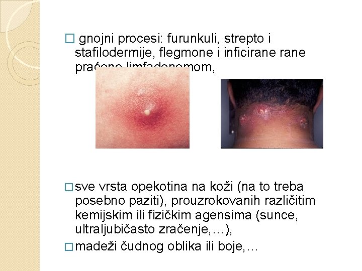 � gnojni procesi: furunkuli, strepto i stafilodermije, flegmone i inficirane praćene limfadenomom, � sve