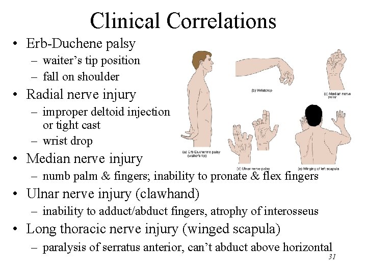 Clinical Correlations • Erb-Duchene palsy – waiter’s tip position – fall on shoulder •