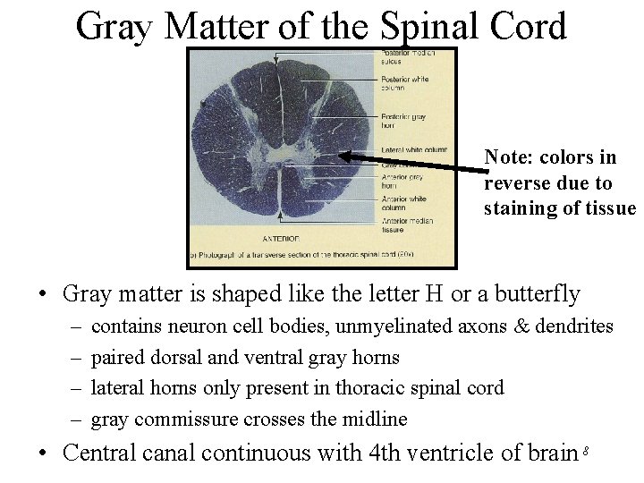Gray Matter of the Spinal Cord Note: colors in reverse due to staining of