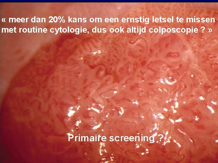 « meer dan 20% kans om een ernstig letsel te missen met routine « meer dan 20% kans om een ernstig letsel te missen met routine