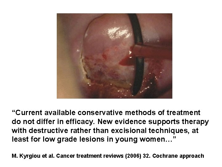 “Current available conservative methods of treatment do not differ in efficacy. New evidence supports “Current available conservative methods of treatment do not differ in efficacy. New evidence supports