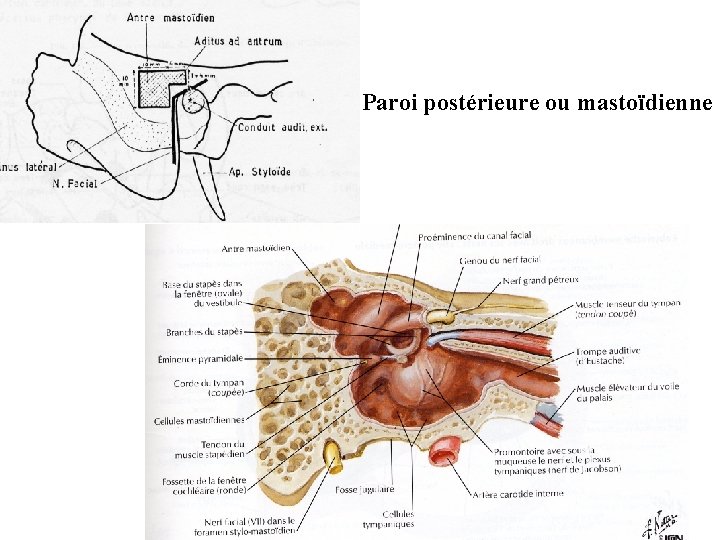 Paroi postérieure ou mastoïdienne 