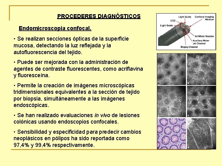 PROCEDERES DIAGNÓSTICOS Endomicroscopia confocal. • Se realizan secciones ópticas de la superficie mucosa, detectando