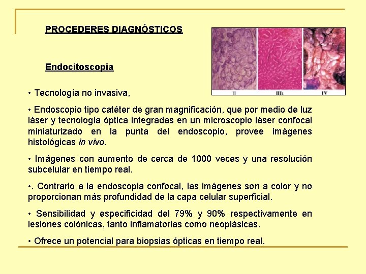 PROCEDERES DIAGNÓSTICOS Endocitoscopia • Tecnología no invasiva, • Endoscopio tipo catéter de gran magnificación,