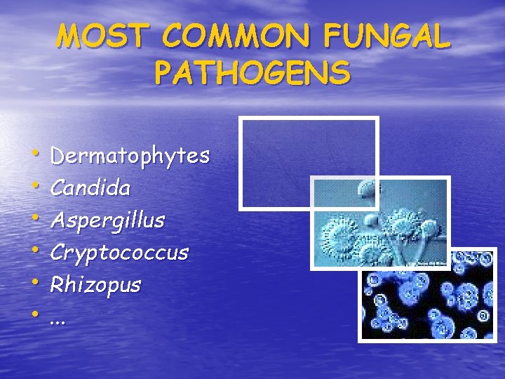 MOST COMMON FUNGAL PATHOGENS • Dermatophytes • Candida • Aspergillus • Cryptococcus • Rhizopus