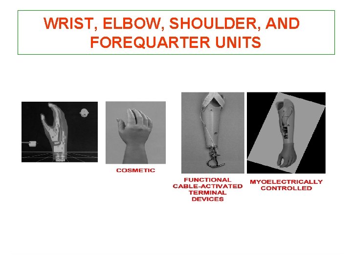 WRIST, ELBOW, SHOULDER, AND FOREQUARTER UNITS 