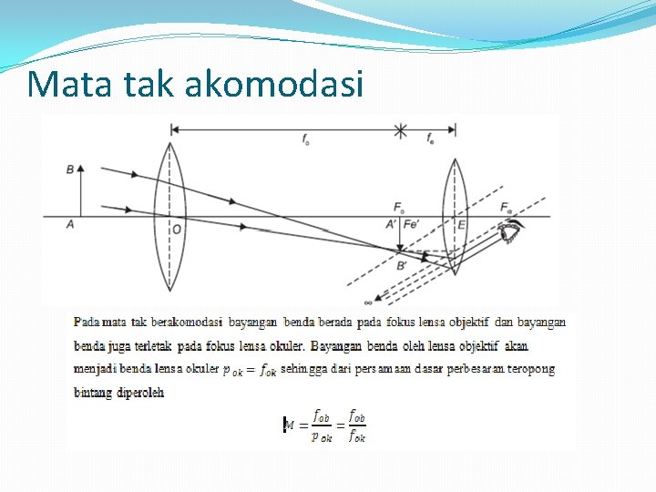 Mata tak akomodasi 