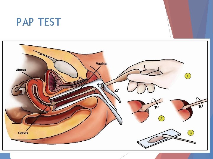 PAP TEST 