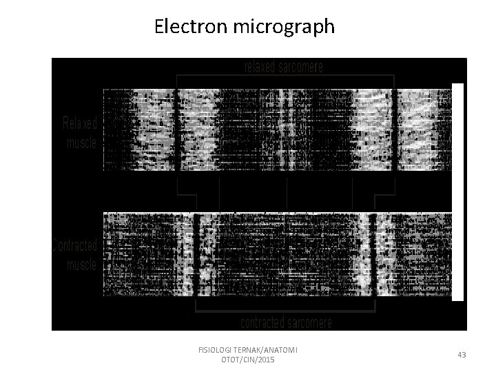 Electron micrograph FISIOLOGI TERNAK/ANATOMI OTOT/CIN/2015 43 