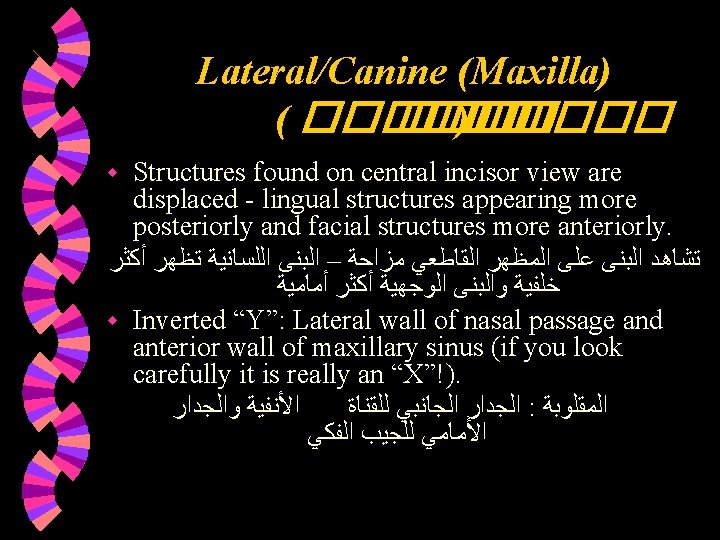 Lateral/Canine (Maxilla) ( ������ )����� Structures found on central incisor view are displaced - Lateral/Canine (Maxilla) ( ������ )����� Structures found on central incisor view are displaced -