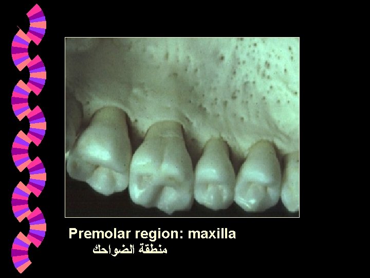 Premolar region: maxilla ﻣﻨﻄﻘﺔ ﺍﻟﻀﻮﺍﺣﻚ Premolar region: maxilla ﻣﻨﻄﻘﺔ ﺍﻟﻀﻮﺍﺣﻚ