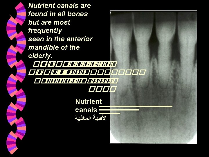 Nutrient canals are found in all bones but are most frequently seen in the Nutrient canals are found in all bones but are most frequently seen in the