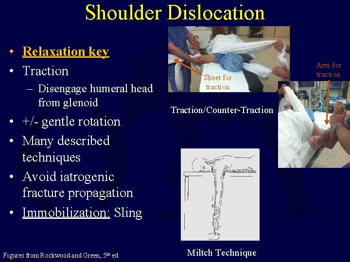 Shoulder Dislocation • Relaxation key • Traction – Disengage humeral head from glenoid •