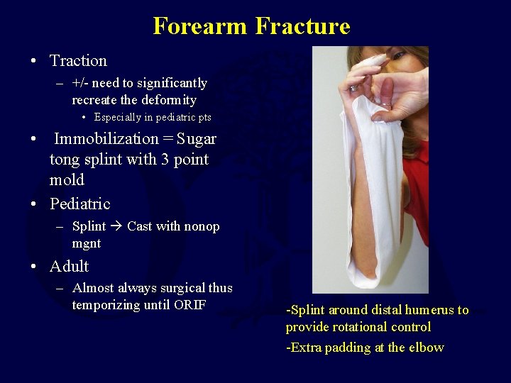 Forearm Fracture • Traction – +/- need to significantly recreate the deformity • Especially