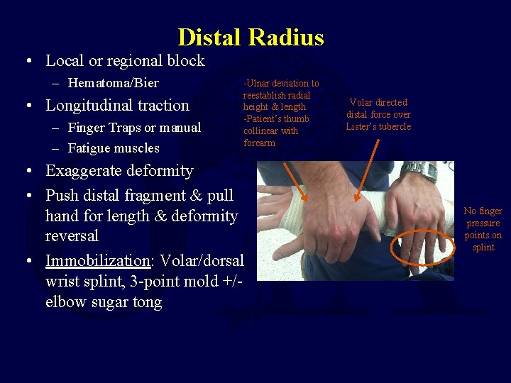 Distal Radius • Local or regional block – Hematoma/Bier • Longitudinal traction – Finger