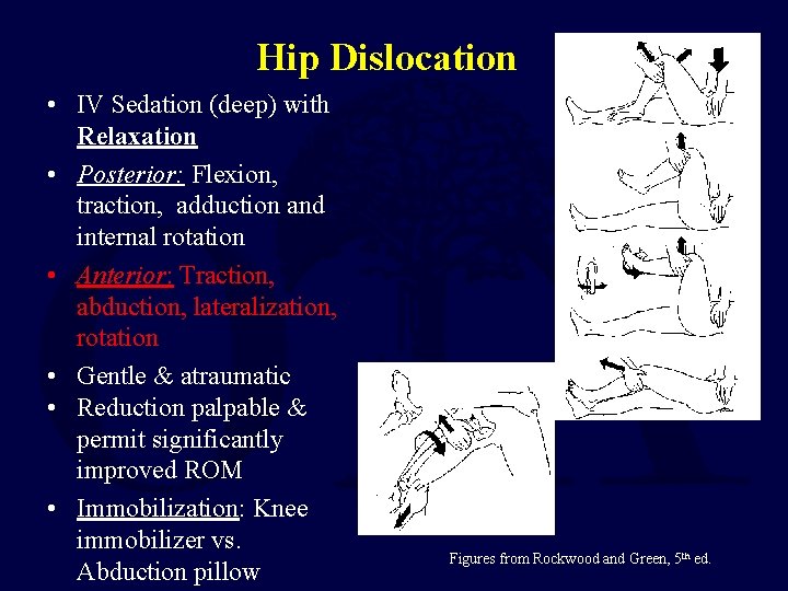 Hip Dislocation • IV Sedation (deep) with Relaxation • Posterior: Flexion, traction, adduction and Hip Dislocation • IV Sedation (deep) with Relaxation • Posterior: Flexion, traction, adduction and