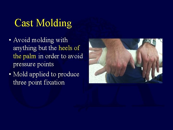 Cast Molding • Avoid molding with anything but the heels of the palm in