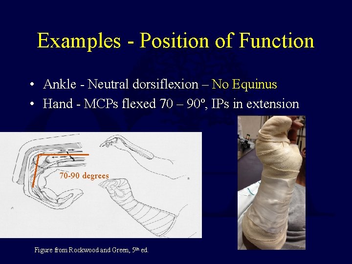 Examples - Position of Function • Ankle - Neutral dorsiflexion – No Equinus •