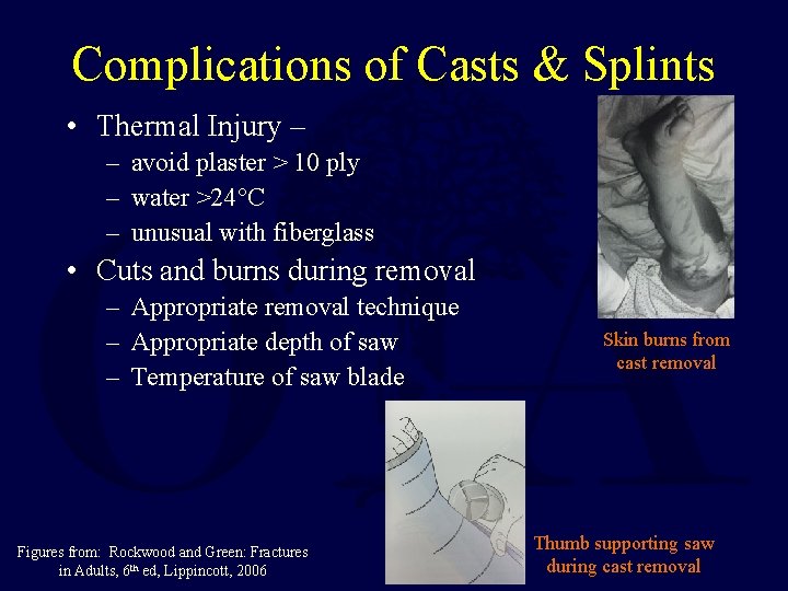 Complications of Casts & Splints • Thermal Injury – – avoid plaster > 10