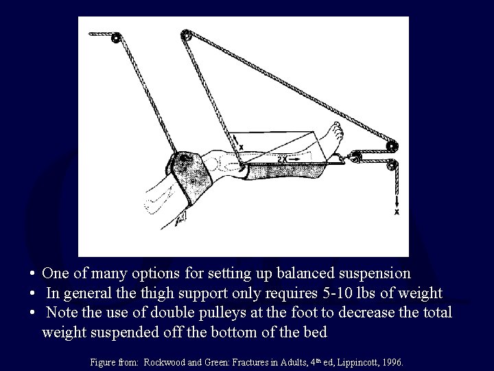 • One of many options for setting up balanced suspension • In general • One of many options for setting up balanced suspension • In general