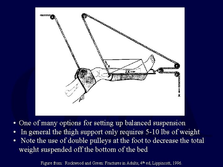  • One of many options for setting up balanced suspension • In general