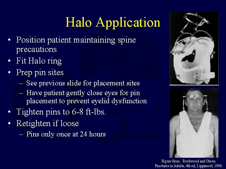 Halo Application • Position patient maintaining spine precautions • Fit Halo ring • Prep