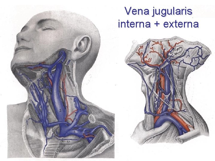 Vena jugularis interna + externa 