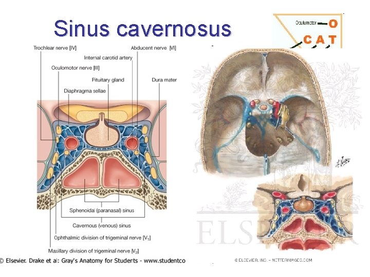 Sinus cavernosus • lateral to sella turcica • little caverns (many chordae Willisi) medially: