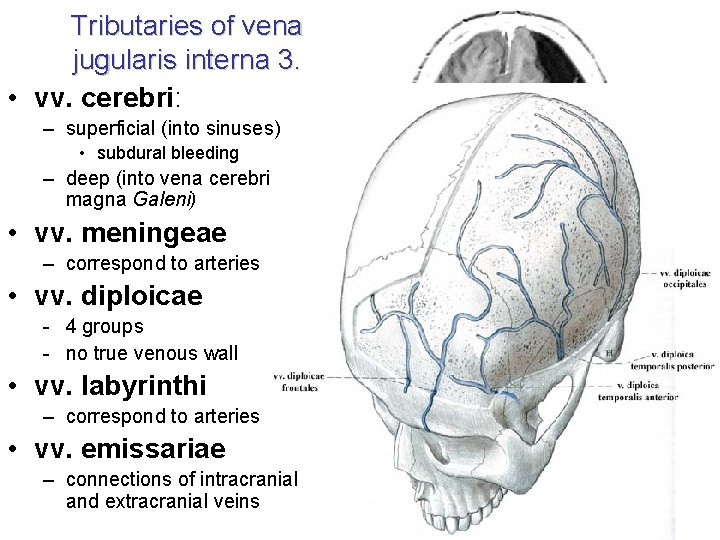 Tributaries of vena jugularis interna 3. • vv. cerebri: – superficial (into sinuses) •