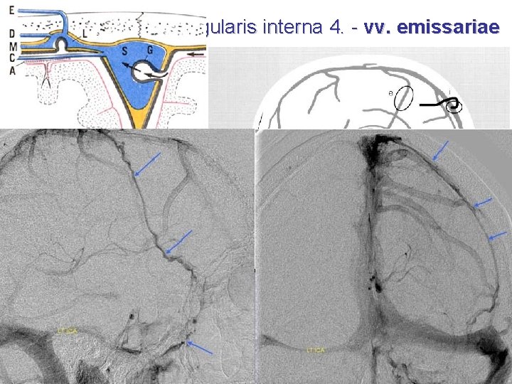 Tributaries of vena jugularis interna 4. - vv. emissariae • v. emissaria – –