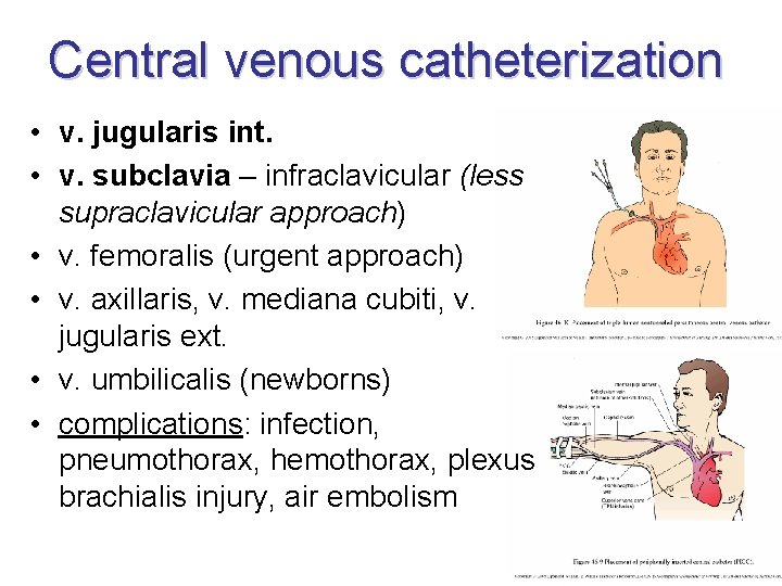 Central venous catheterization • v. jugularis int. • v. subclavia – infraclavicular (less supraclavicular Central venous catheterization • v. jugularis int. • v. subclavia – infraclavicular (less supraclavicular