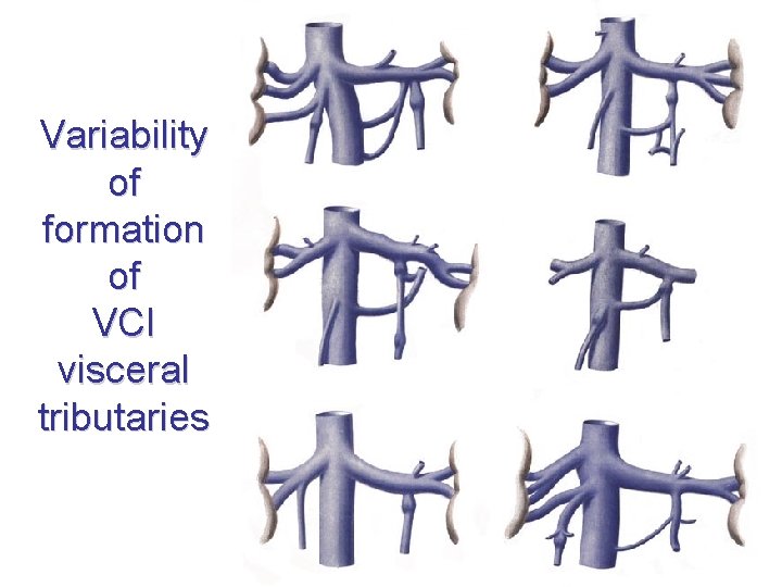 Variability of formation of VCI visceral tributaries 